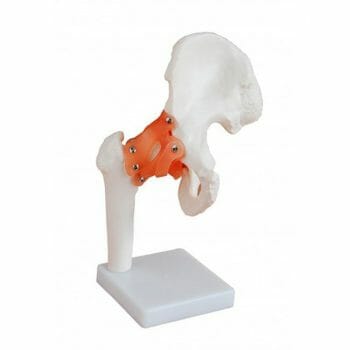 ANATOMIC MODEL HIP JOINT REAL SIZE XC-110