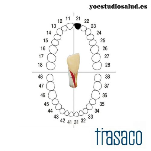 FRASACO DIENTE AG-3 ZPUK #21 ENDODONCIA