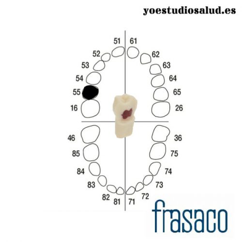 FRASACO CHILD TOOTH ZPUW 55