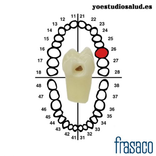 FRASACO DIENTE CARIADO ZSDK 26