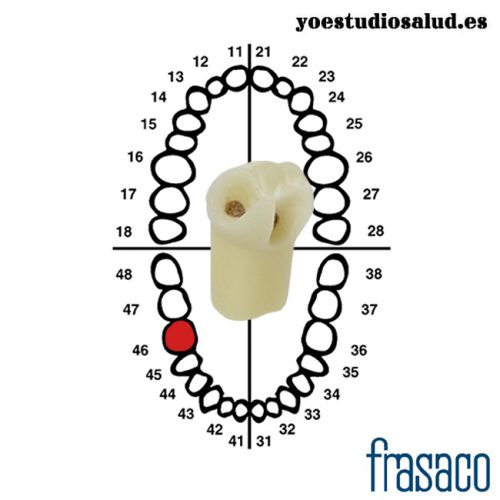 FRASACO DIENTE CARIADO ZSDK 46